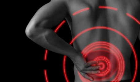 Cortisone for Sciatica
